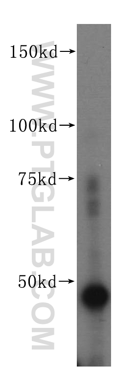 FEN1 Polyclonal antibody