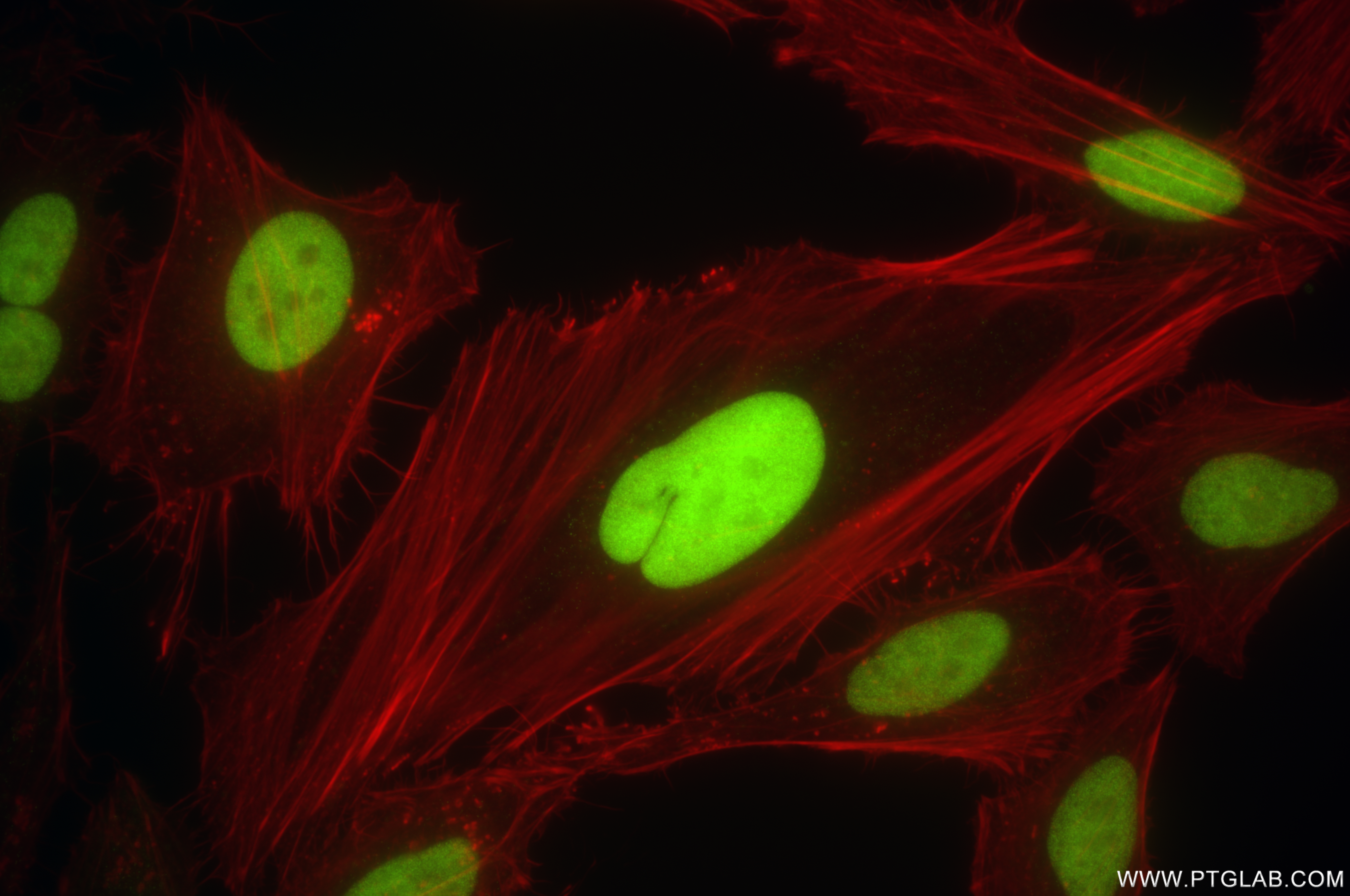 IF Staining of HeLa using 84916-5-RR
