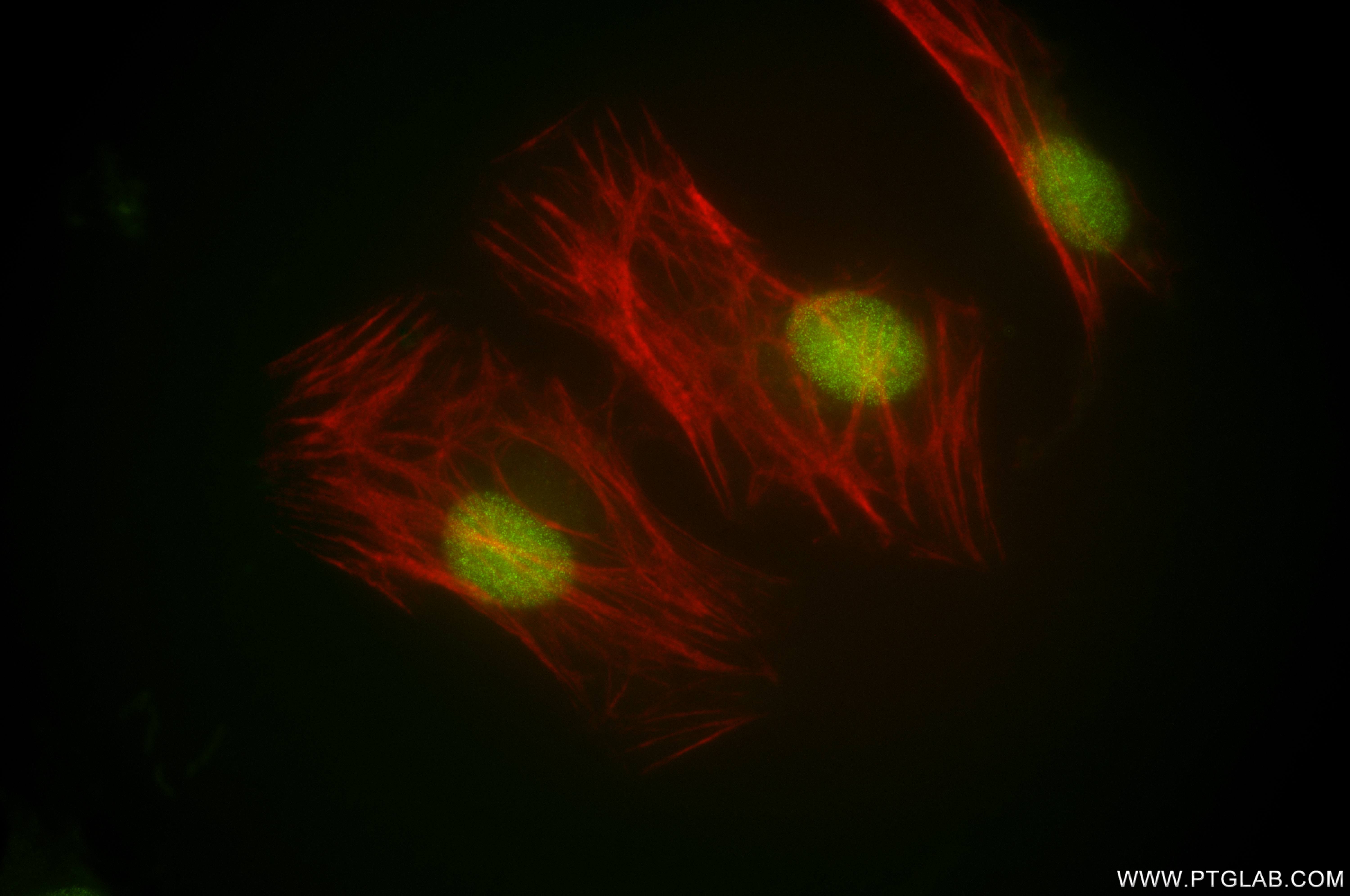 IF Staining of HeLa using 84916-6-RR (same clone as 84916-6-PBS)