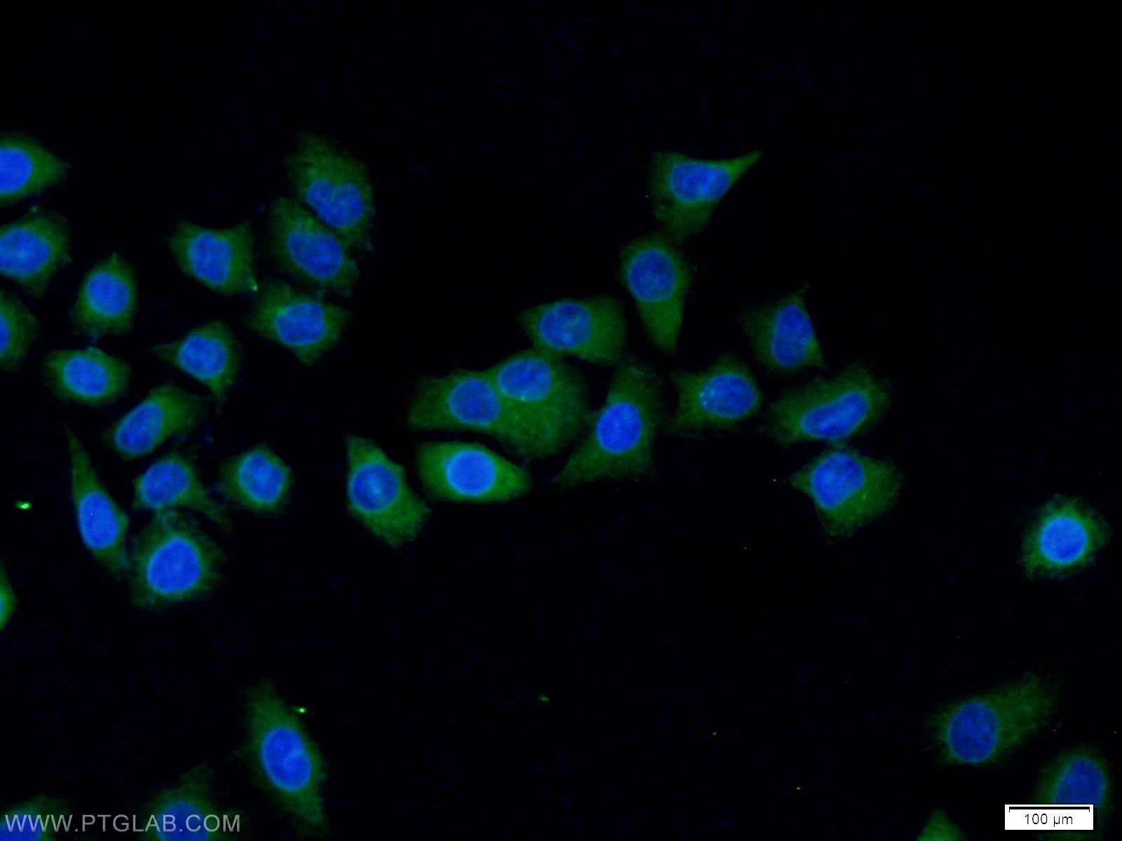 IF Staining of MCF-7 using 25287-1-AP