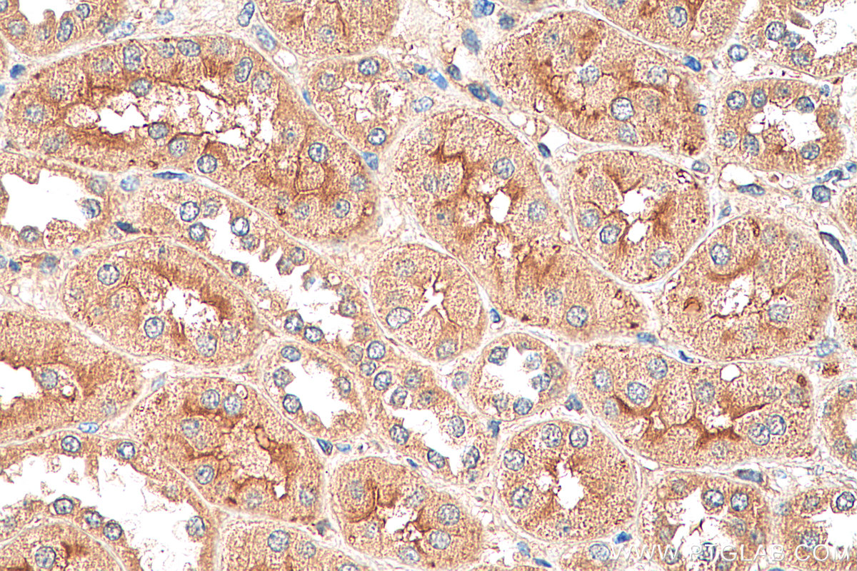 IHC staining of human kidney using 25287-1-AP