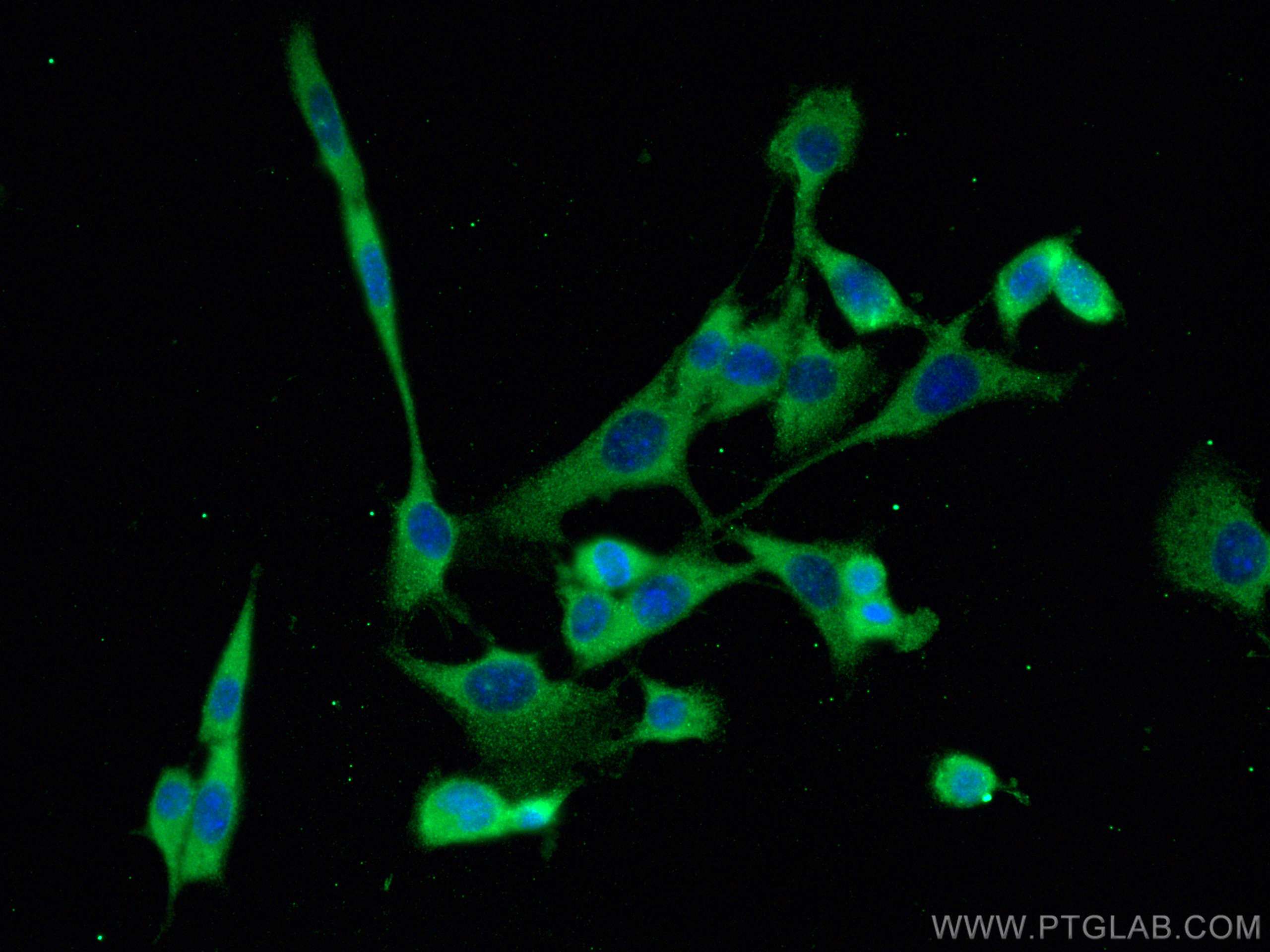 IF Staining of NIH/3T3 using 67671-1-Ig (same clone as 67671-1-PBS)