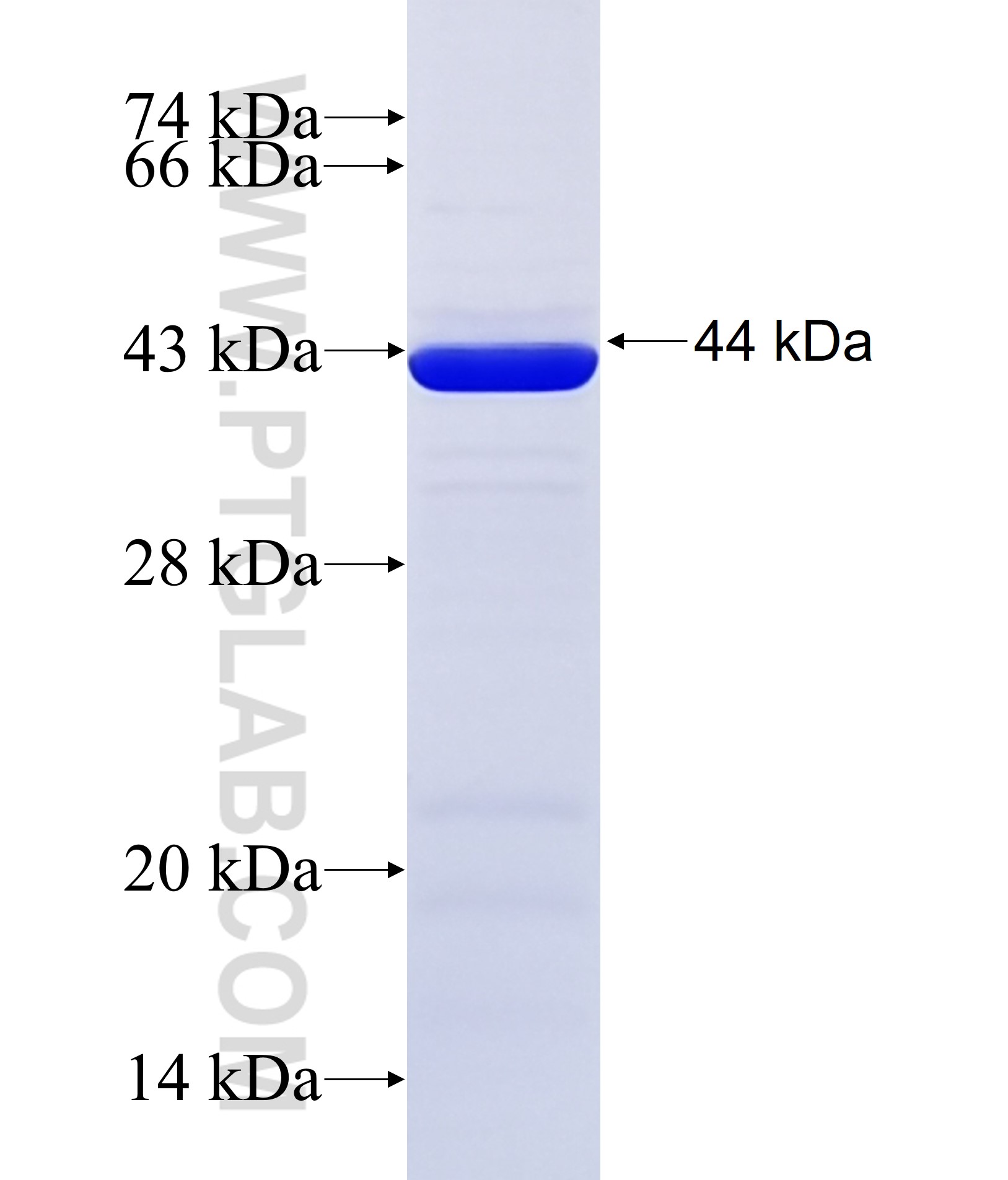 FER1L5 fusion protein Ag38099 SDS-PAGE FER1L5 fusion protein Ag38099 SDS-PAGE