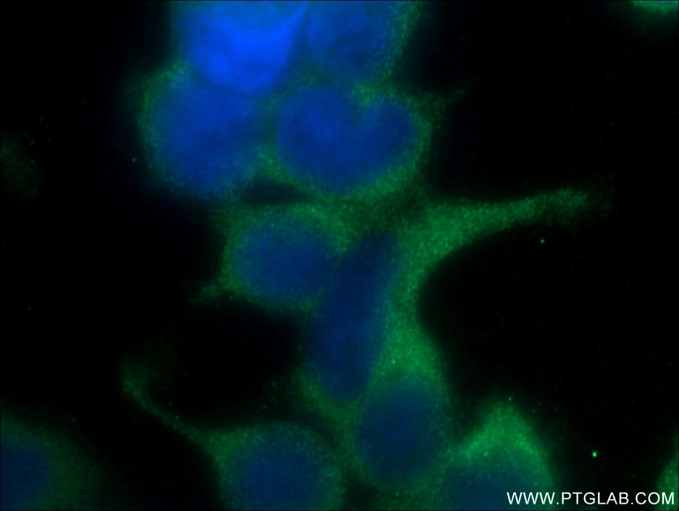 IF Staining of HEK-293 using 22215-1-AP