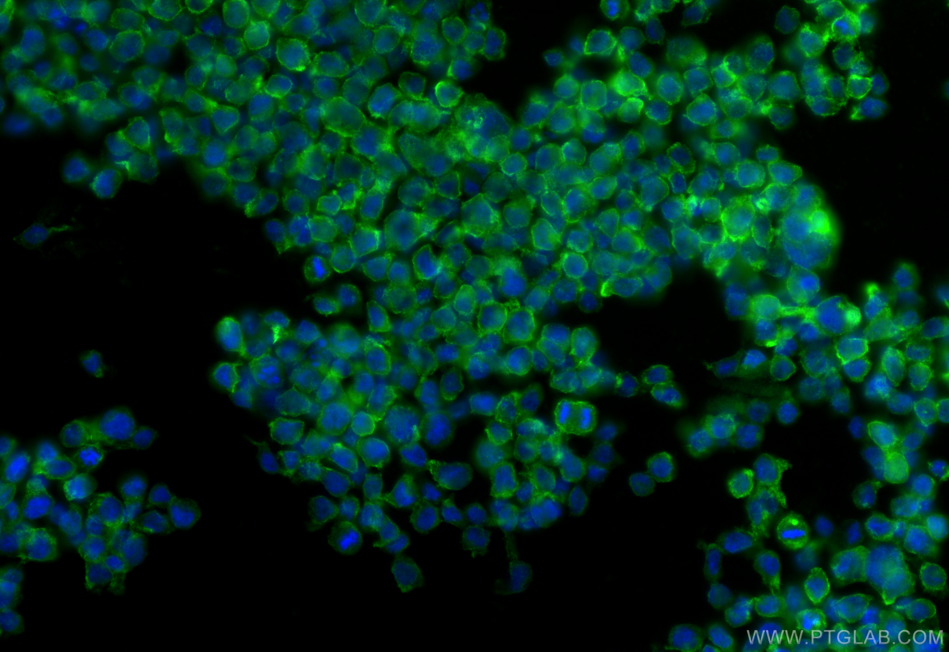 IF Staining of THP-1 using 18131-1-AP