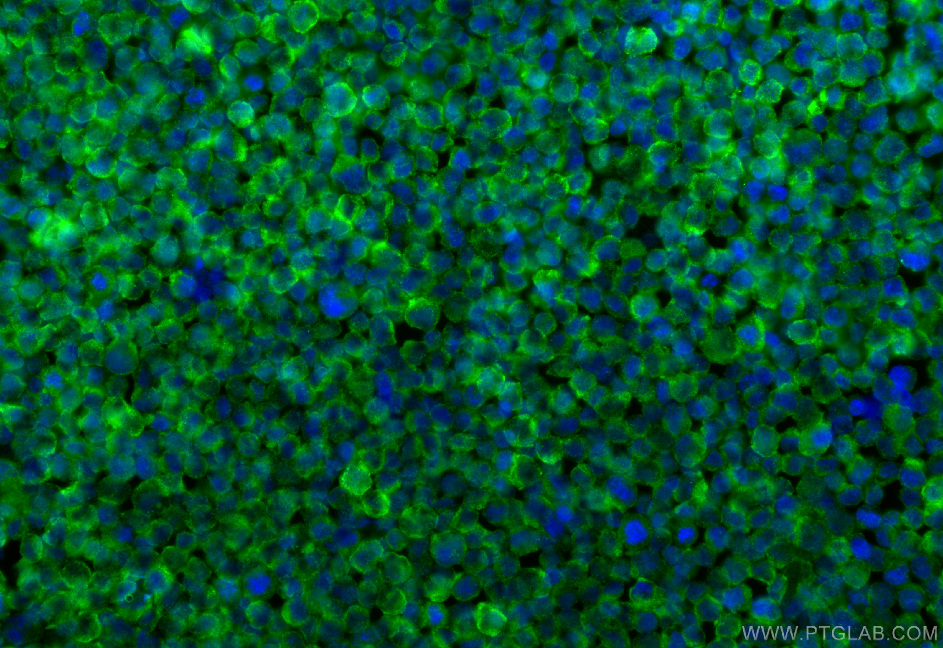 Immunofluorescent analysis of (4% PFA) fixed Raji cells using Kindlin 3 antibody (18131-1-AP) at dilution of 1:400 and CoraLite®488-Conjugated Goat Anti-Rabbit IgG(H+L) (<a class='green' href='/productredirect?CatalogNo=SA00013-2' target='_blank'>SA00013-2</a>). IF Staining of Raji using 18131-1-AP