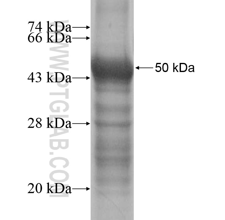 FEZF2 fusion protein Ag16232 SDS-PAGE FEZF2 fusion protein Ag16232 SDS-PAGE