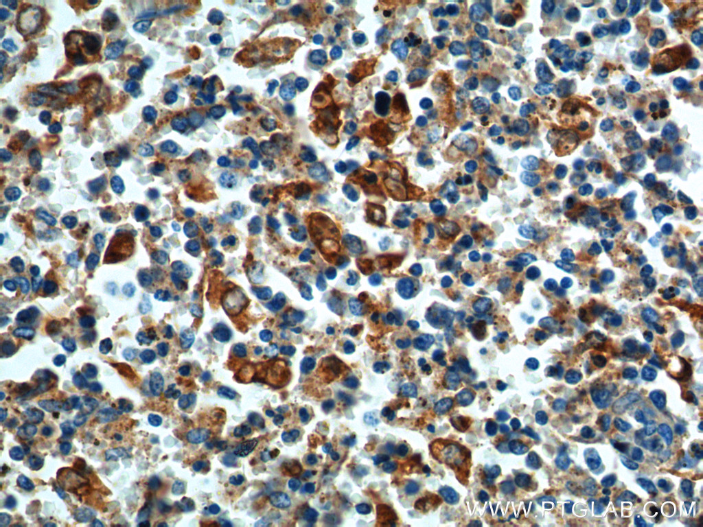 IHC staining of human spleen using 19952-1-AP