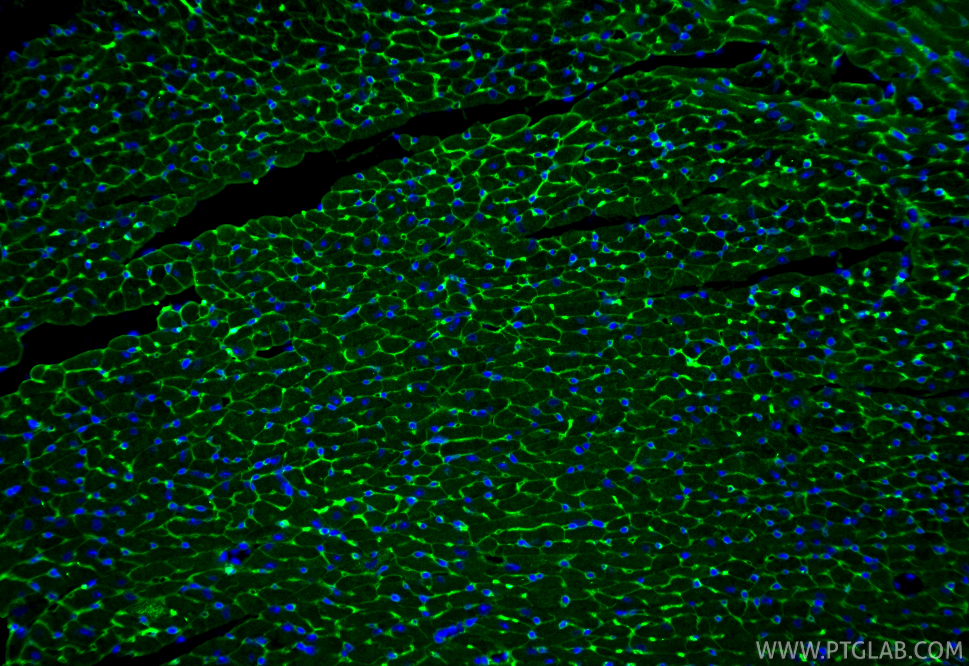 IF Staining of mouse heart using 16747-1-AP IF Staining of mouse heart using 16747-1-AP