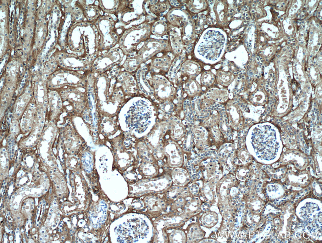 IHC staining of human kidney using 16747-1-AP