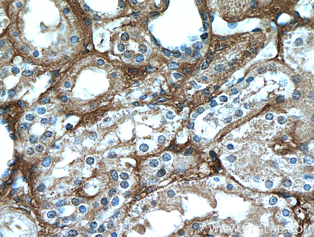 IHC staining of human kidney using 16747-1-AP