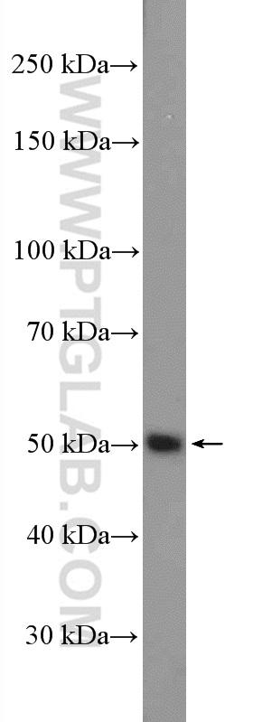 WB analysis of mouse heart using 16747-1-AP