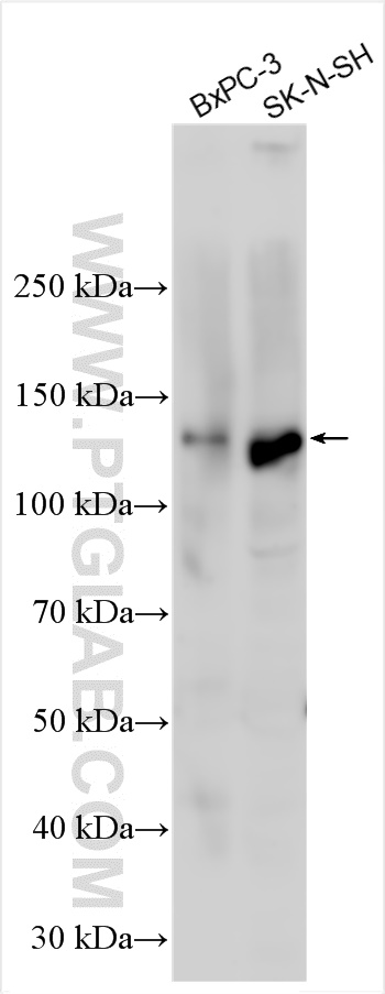 WB analysis using 13141-1-AP