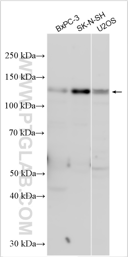 WB analysis using 13141-1-AP