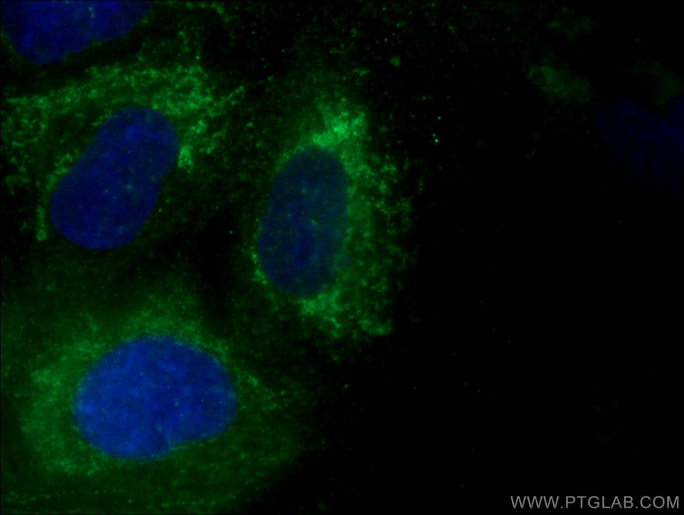 IF Staining of A549 using 20347-1-AP