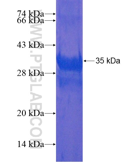 FGD4 fusion protein Ag21697 SDS-PAGE FGD4 fusion protein Ag21697 SDS-PAGE
