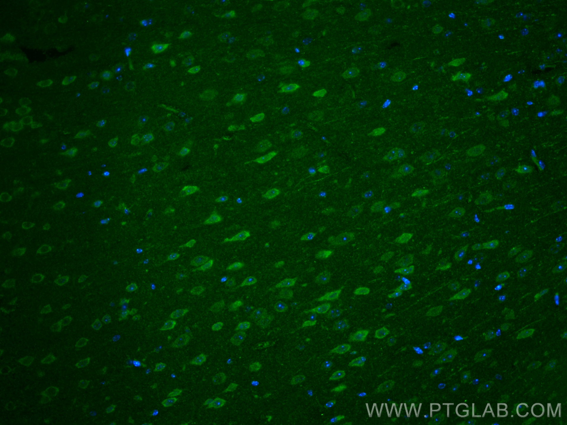 IF Staining of mouse brain using 29749-1-AP