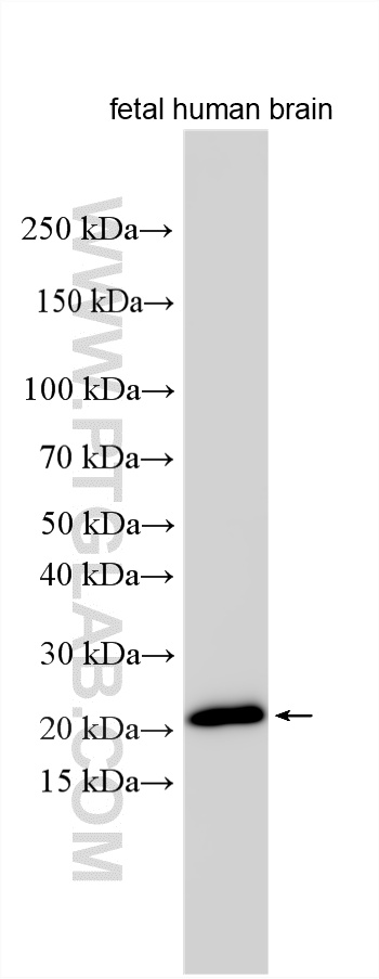 WB analysis using 26235-1-AP