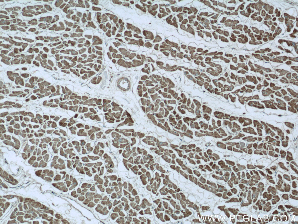 IHC staining of human heart using 16876-1-AP