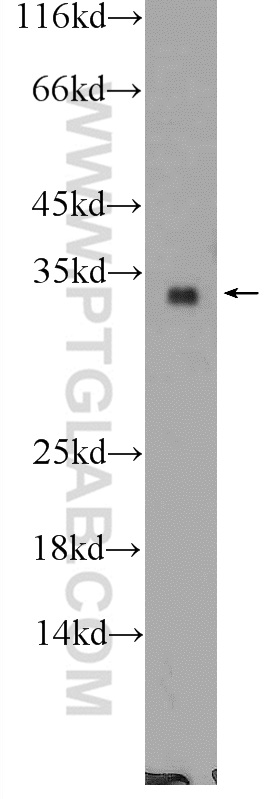 WB analysis of MCF-7 using 25314-1-AP