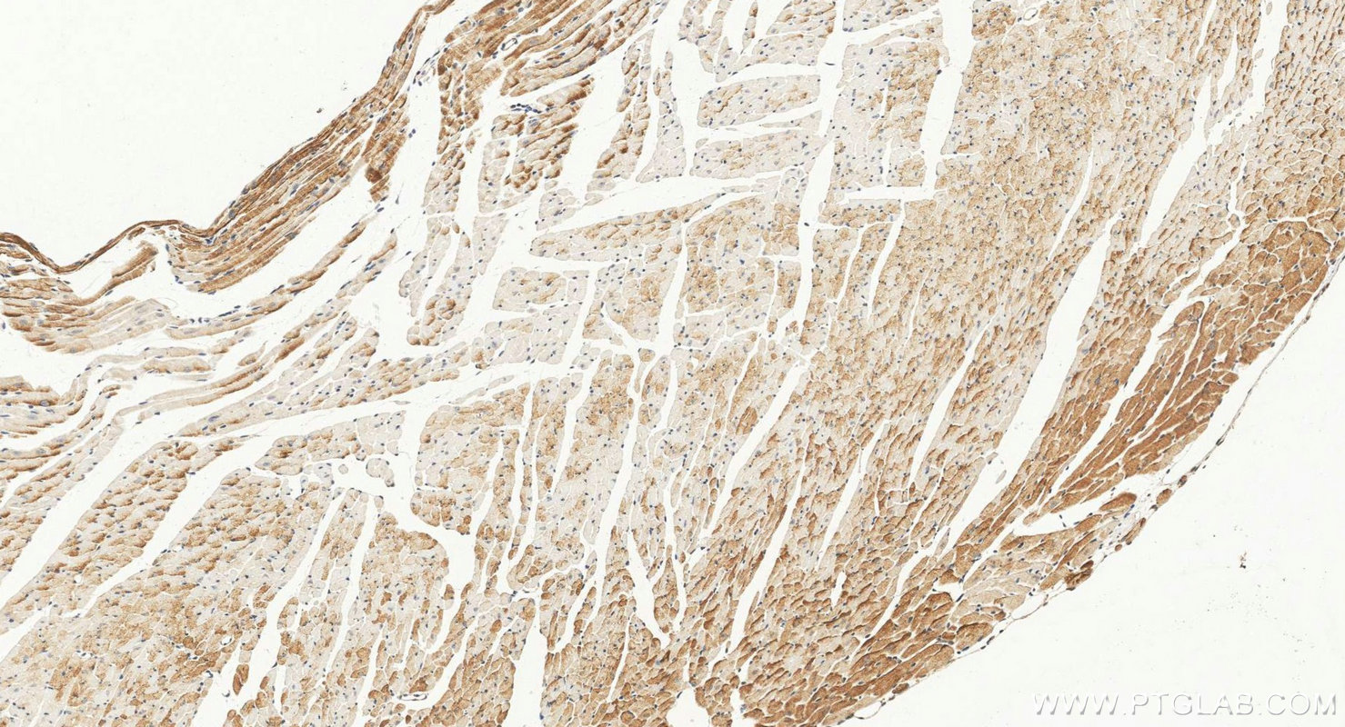 IHC staining of mouse heart using 11495-1-AP IHC staining of mouse heart using 11495-1-AP