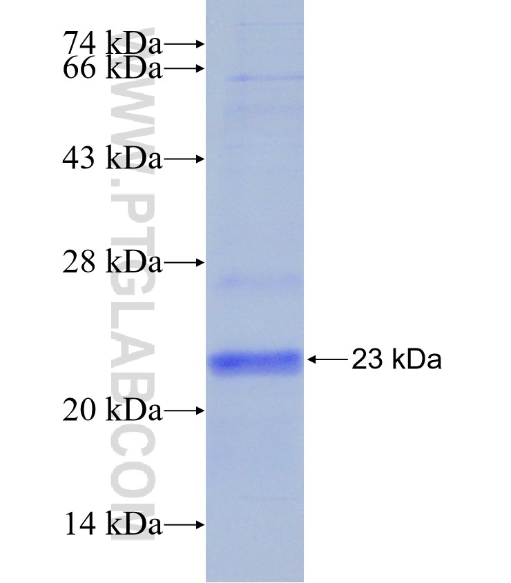 FGF21 fusion protein Ag24191 SDS-PAGE