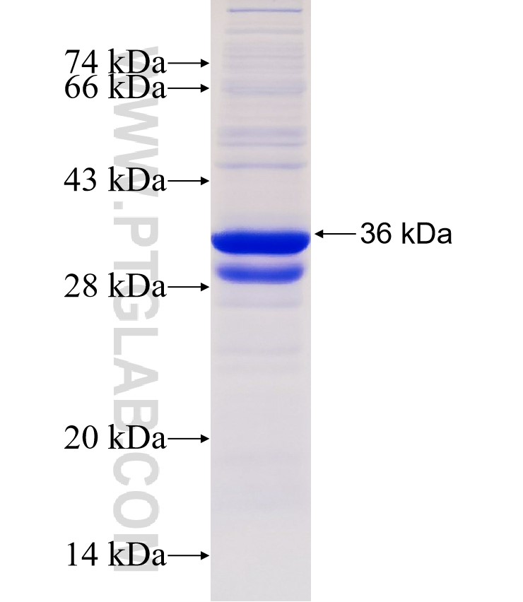 FGF5 fusion protein Ag31721 SDS-PAGE FGF5 fusion protein Ag31721 SDS-PAGE