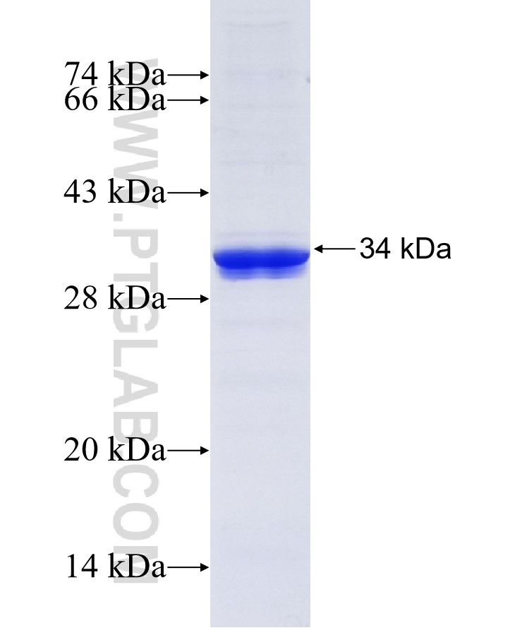 FGF5 fusion protein Ag12936 SDS-PAGE FGF5 fusion protein Ag12936 SDS-PAGE