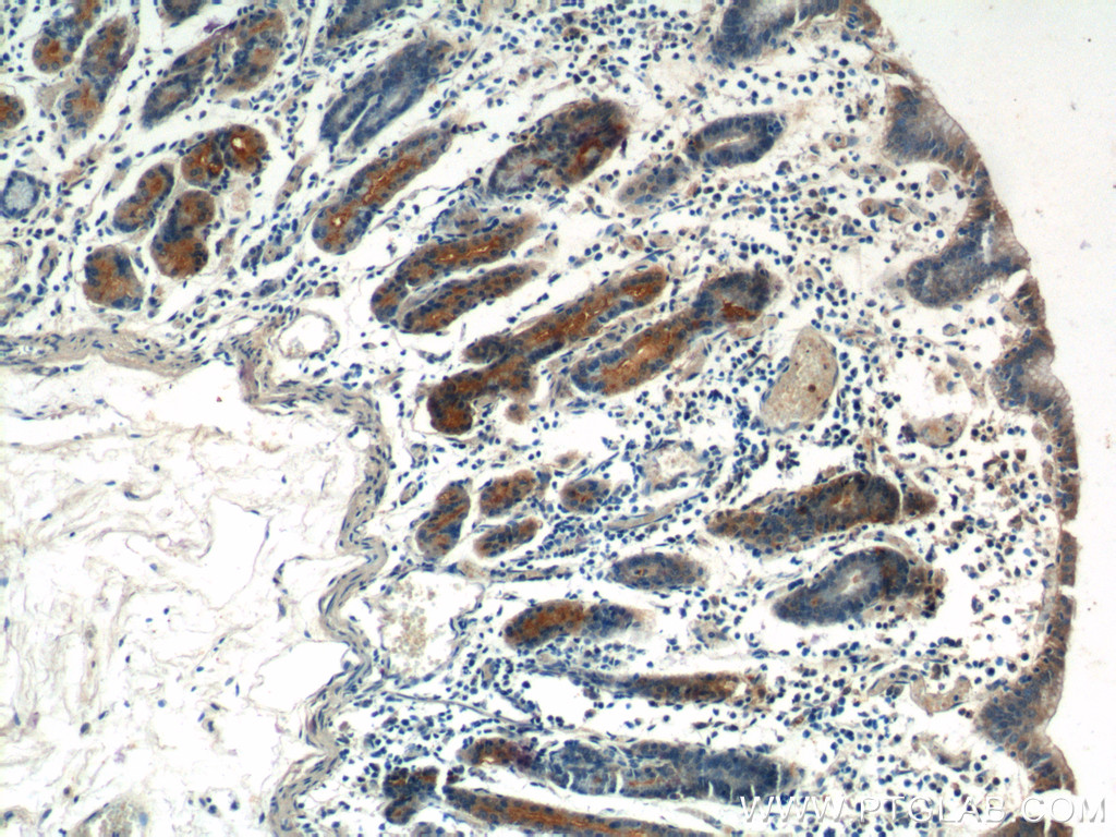 IHC staining of human stomach using 26554-1-AP