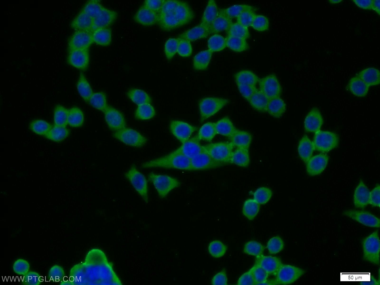 IF Staining of BxPC-3 using 13254-1-AP