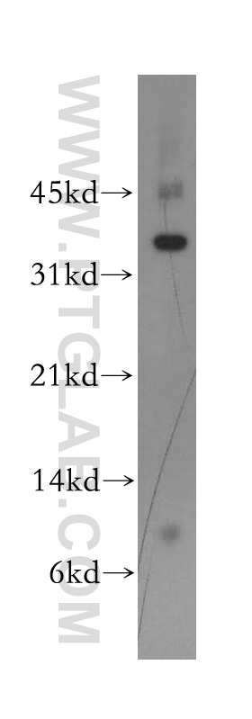 WB analysis of SH-SY5Y using 13254-1-AP