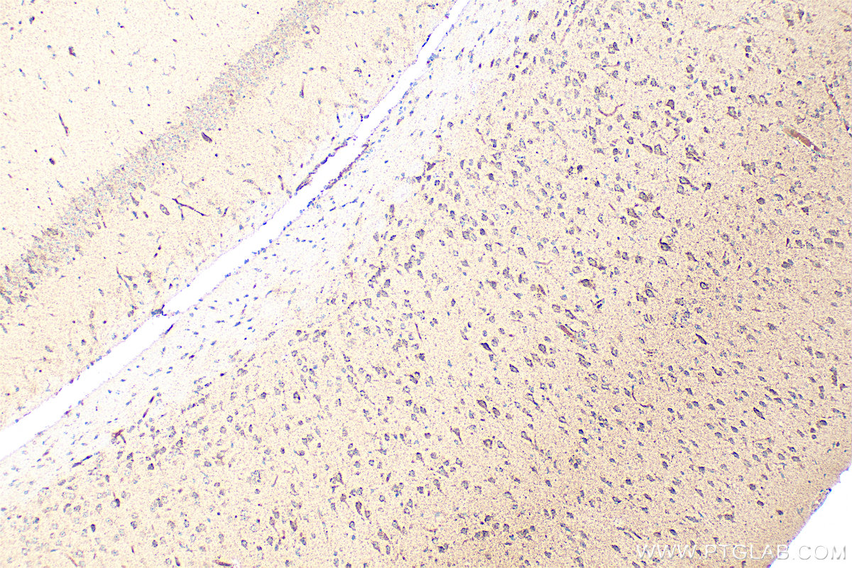 IHC staining of mouse brain using 30358-1-AP
