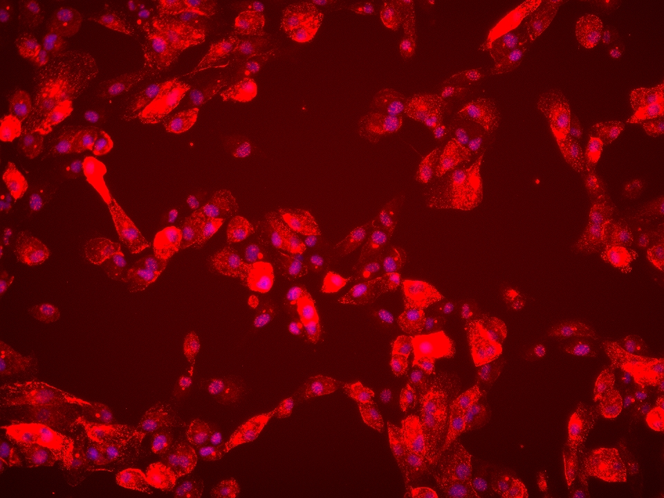 IF Staining of ACHN using 60325-1-Ig (same clone as 60325-1-PBS)