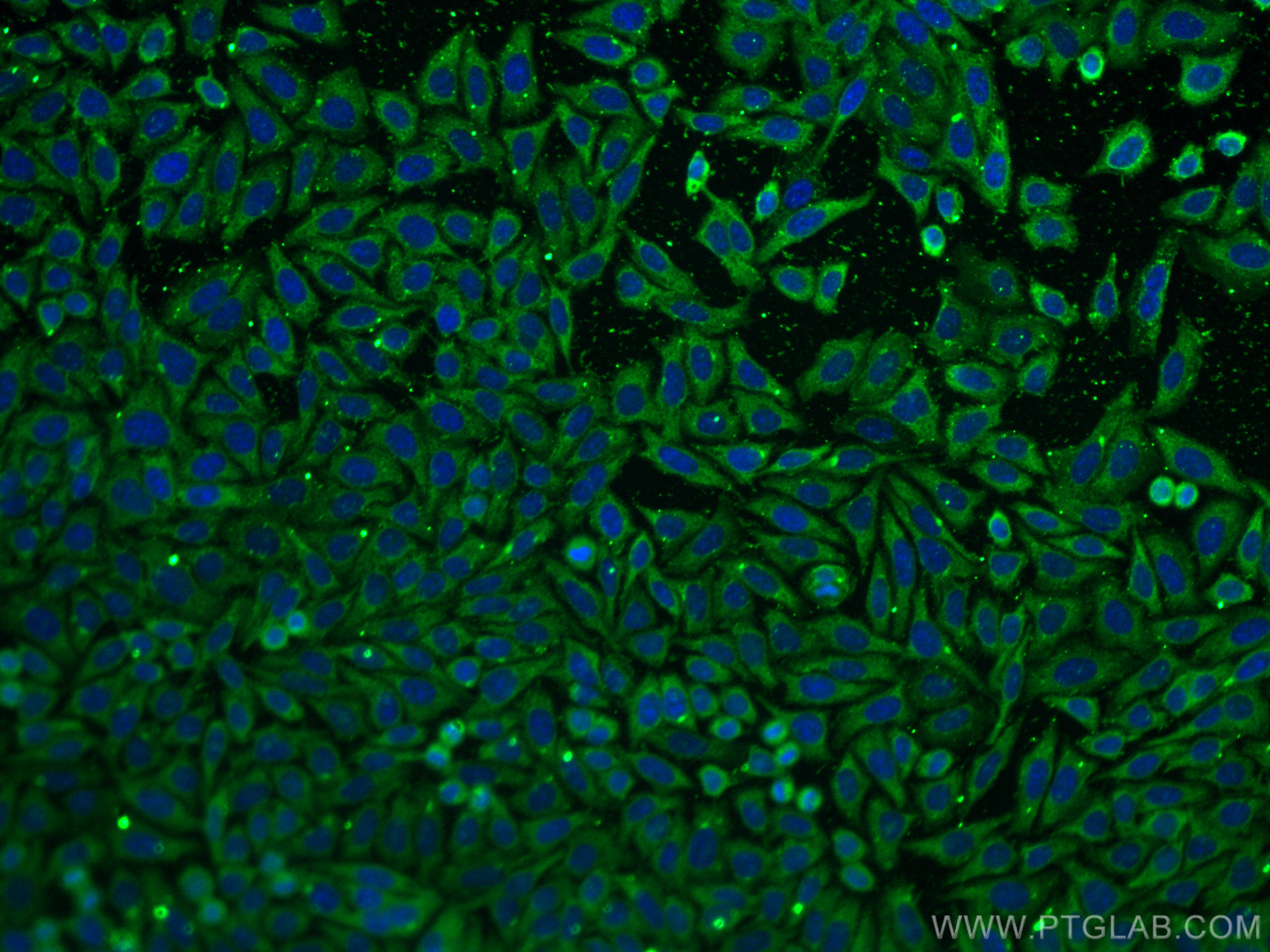 IF Staining of HepG2 using 66954-1-Ig (same clone as 66954-1-PBS)