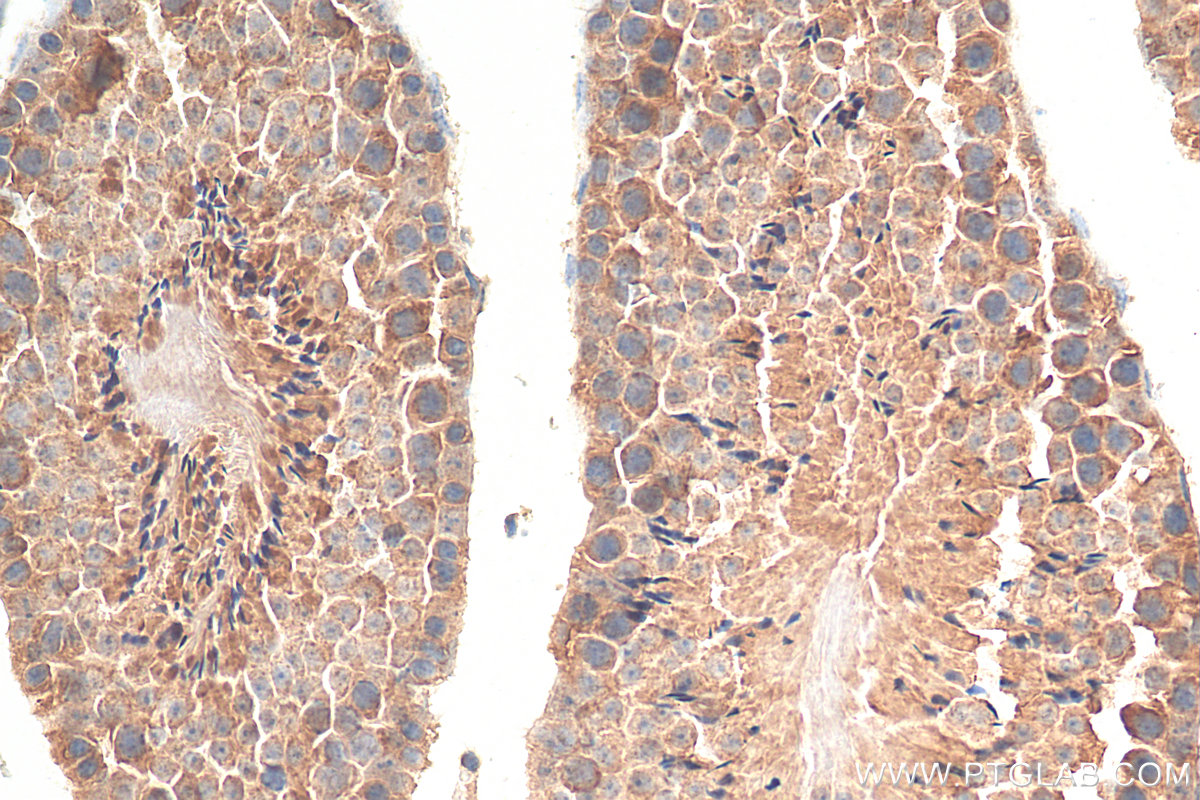 IHC staining of mouse testis using 66954-1-Ig