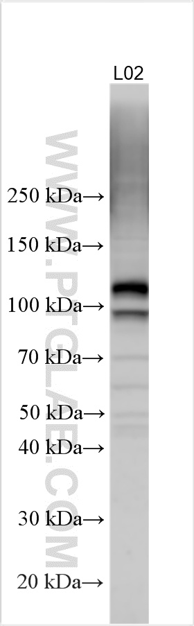 Various lysates were subjected to SDS PAGE followed by western blot with 11098-1-AP (FGFR4 antibody) at dilution of 1:1000 incubated at room temperature for 1.5 hours. WB analysis using 11098-1-AP