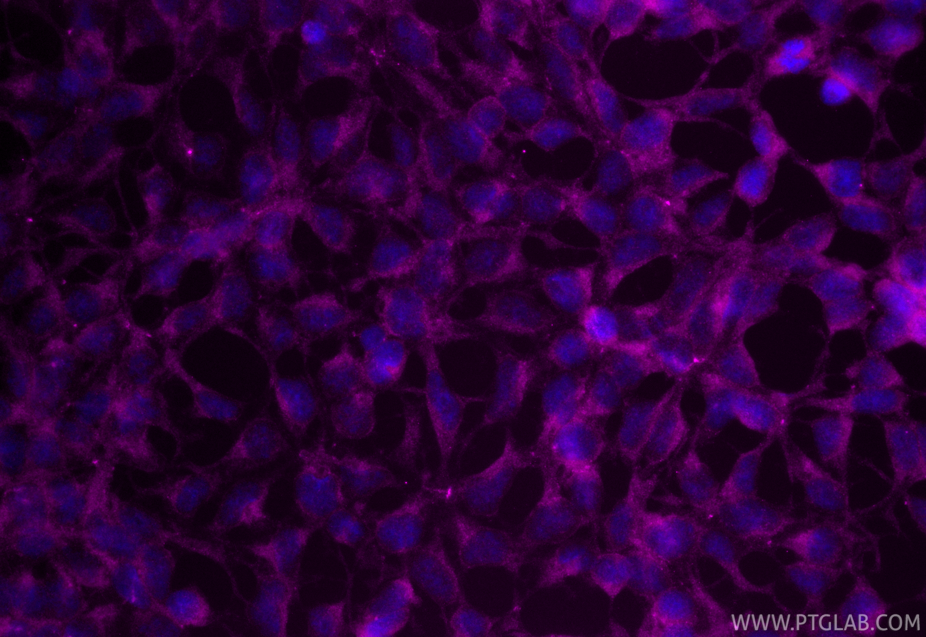 Immunofluorescent analysis of (-20°C Ethanol) fixed HEK-293 cells using CoraLite® Plus 647 FGFR4 antibody (CL647-11098) at dilution of 1:200. IF Staining of HEK-293 using CL647-11098
