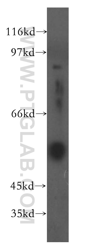 Fibrinogen Gamma Chain Polyclonal antibody