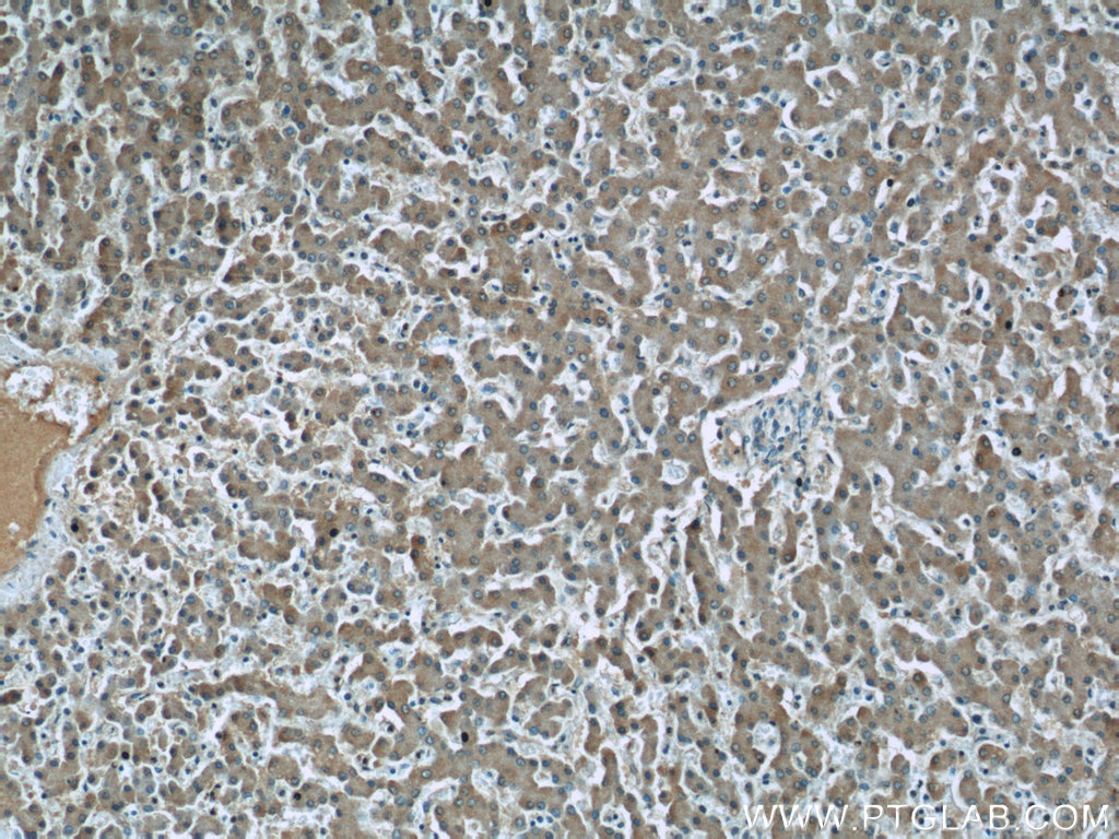Fibrinogen Gamma Chain