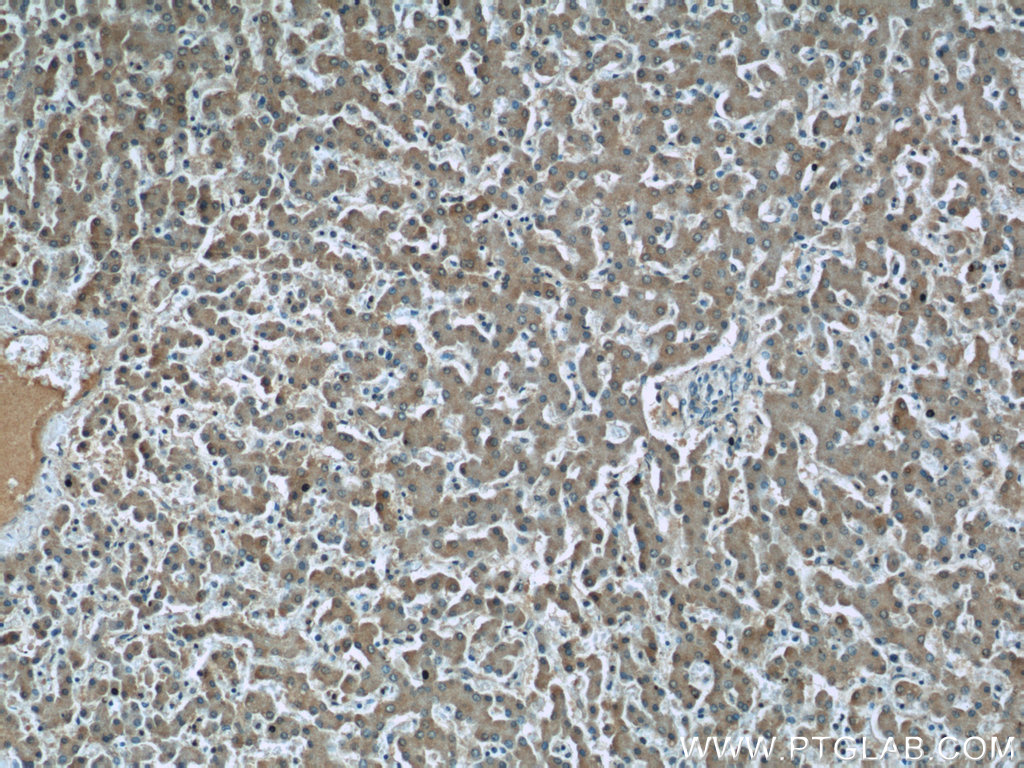 IHC staining of human liver using 66158-1-Ig