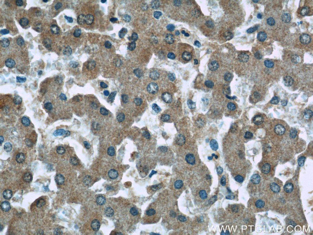 IHC staining of human liver using 66158-1-Ig