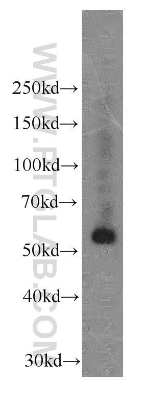 WB analysis of L02 using 66158-1-Ig