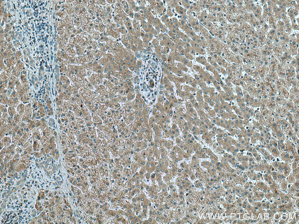 IHC staining of human liver using 67391-1-Ig