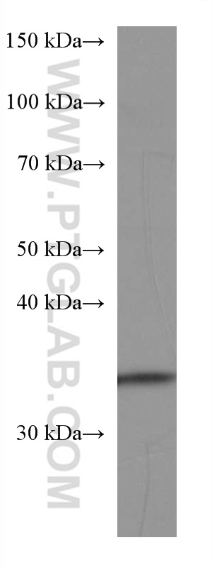 WB analysis of pig liver using 67391-1-Ig