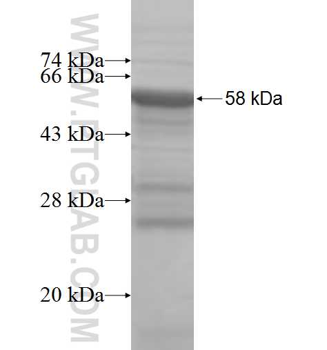 FGL1 fusion protein Ag8593 SDS-PAGE FGL1 fusion protein Ag8593 SDS-PAGE