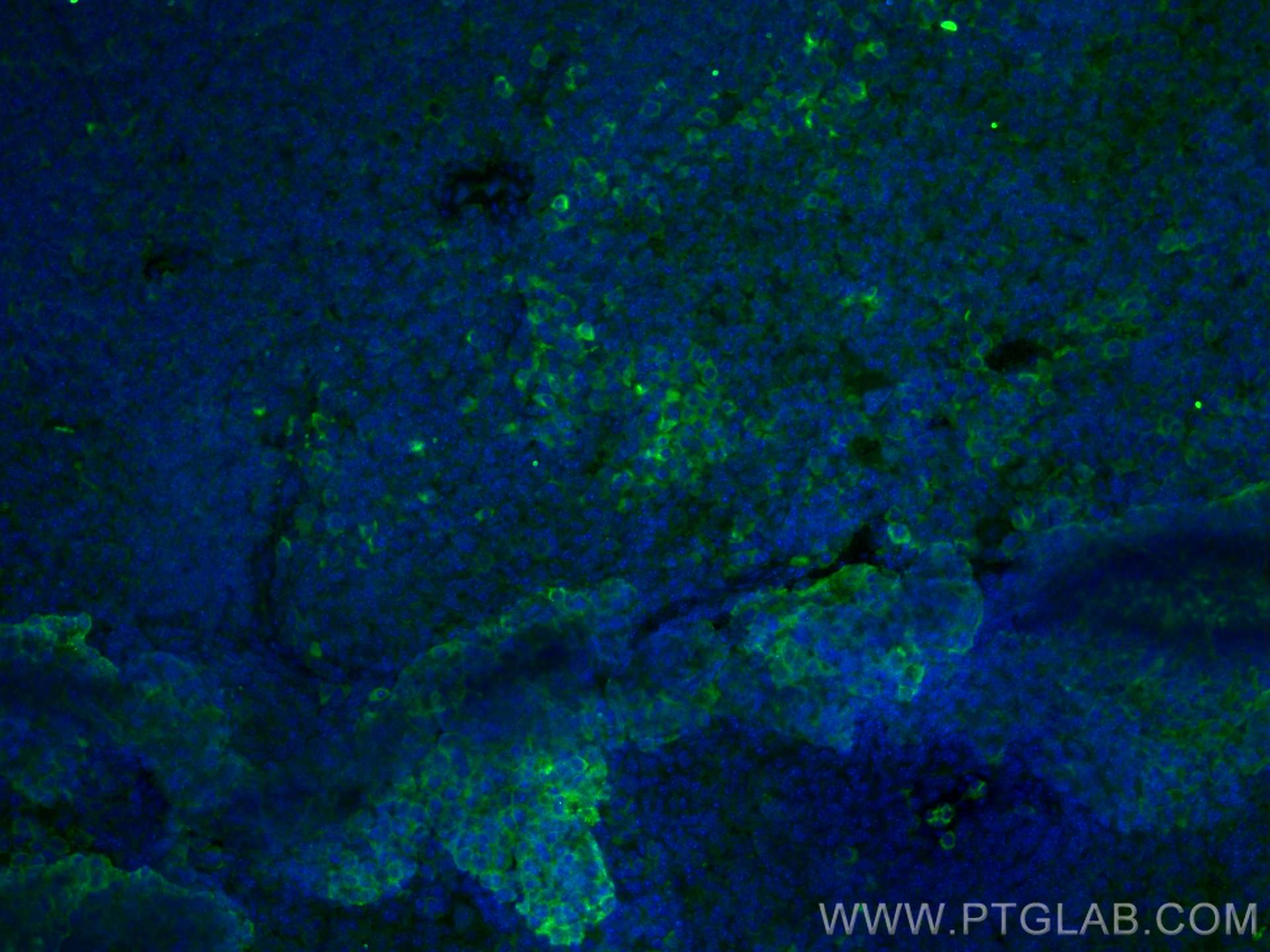 IF Staining of mouse spleen using 67152-1-Ig (same clone as 67152-1-PBS)