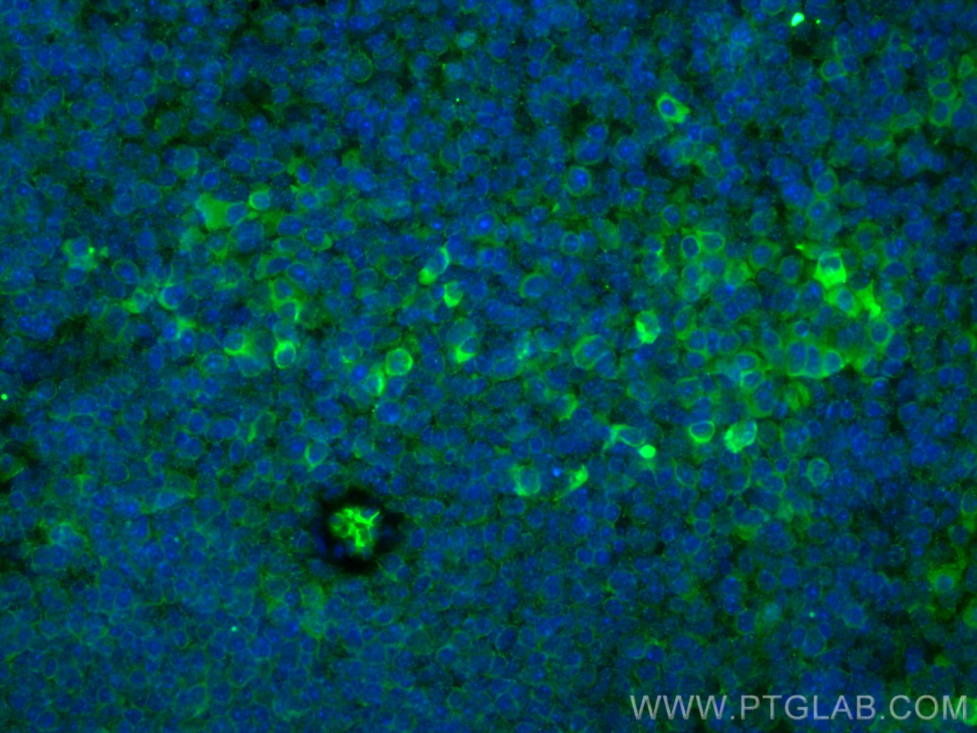IF Staining of mouse spleen using 67152-1-Ig (same clone as 67152-1-PBS)