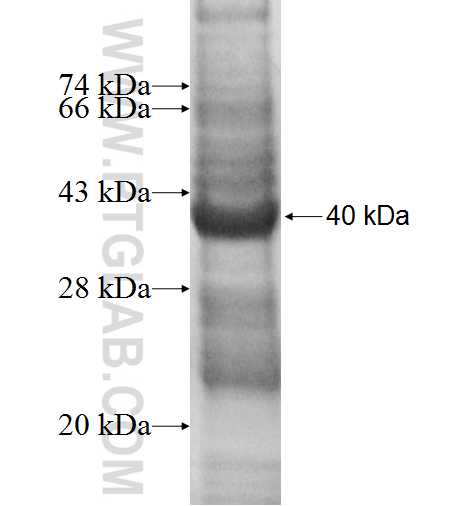 FGL2 fusion protein Ag2395 SDS-PAGE