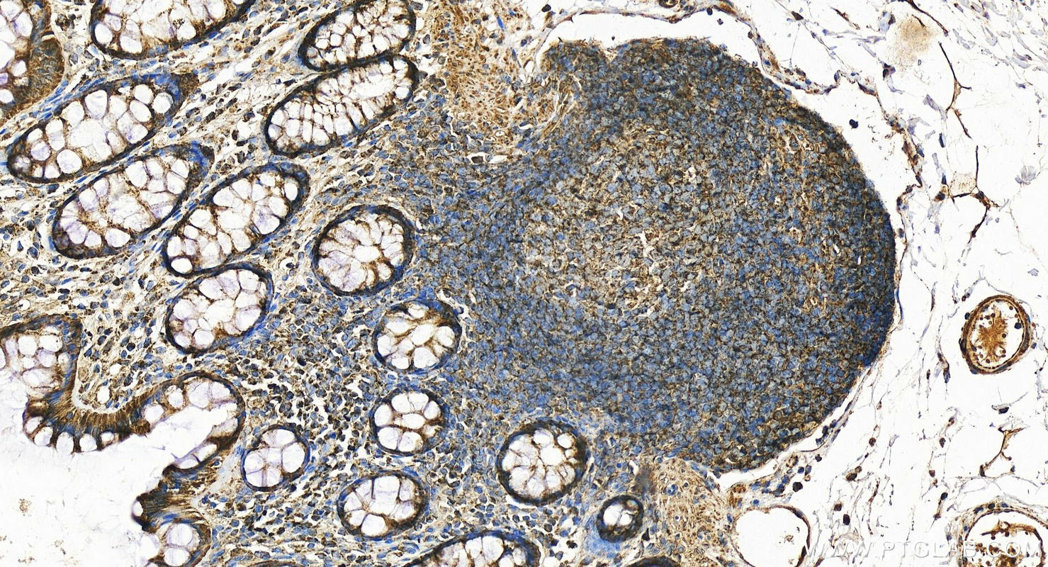 IHC staining of human colon using 10966-1-AP