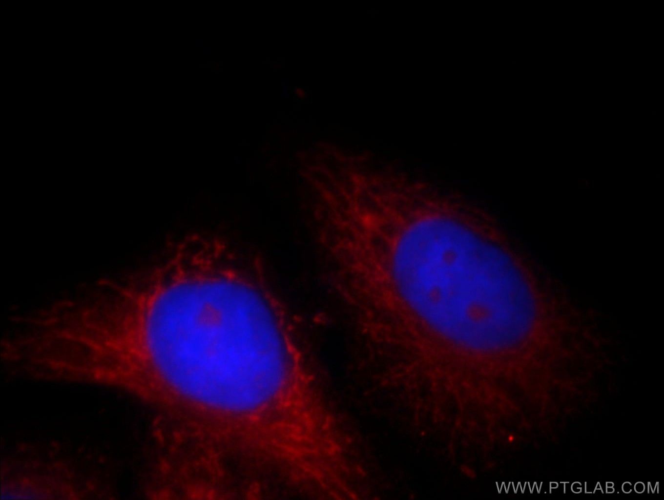 IF Staining of HepG2 using 10966-1-AP